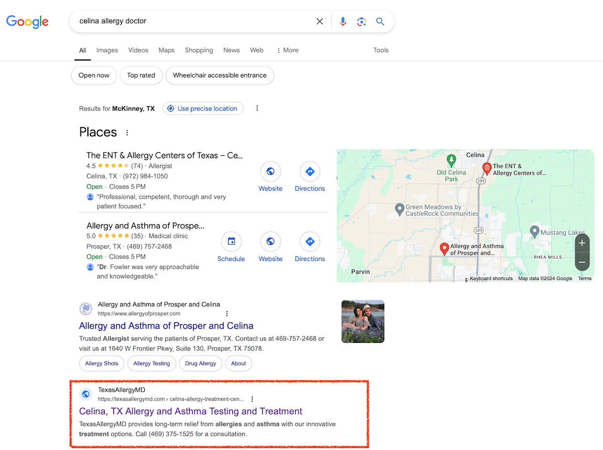 Screenshot of organic search results for an allergy doctor.